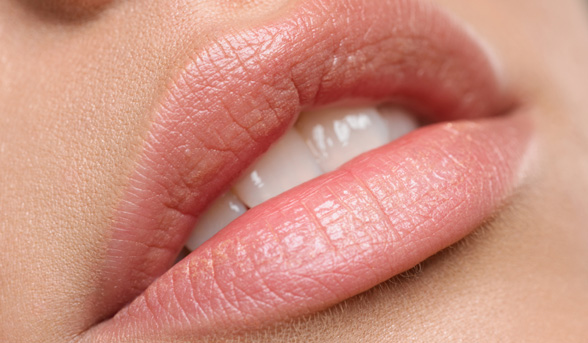 Fast fixes for dry lips