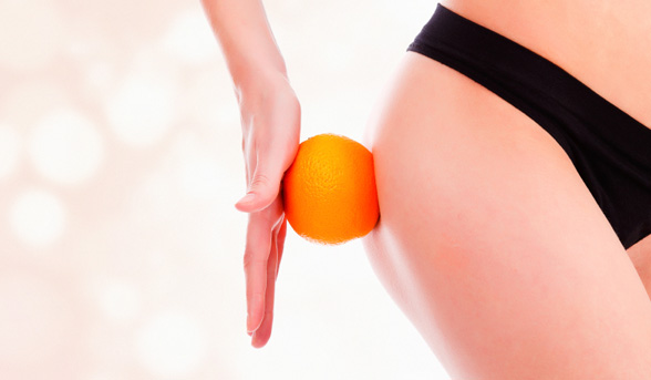 5 of the best products to treat cellulite