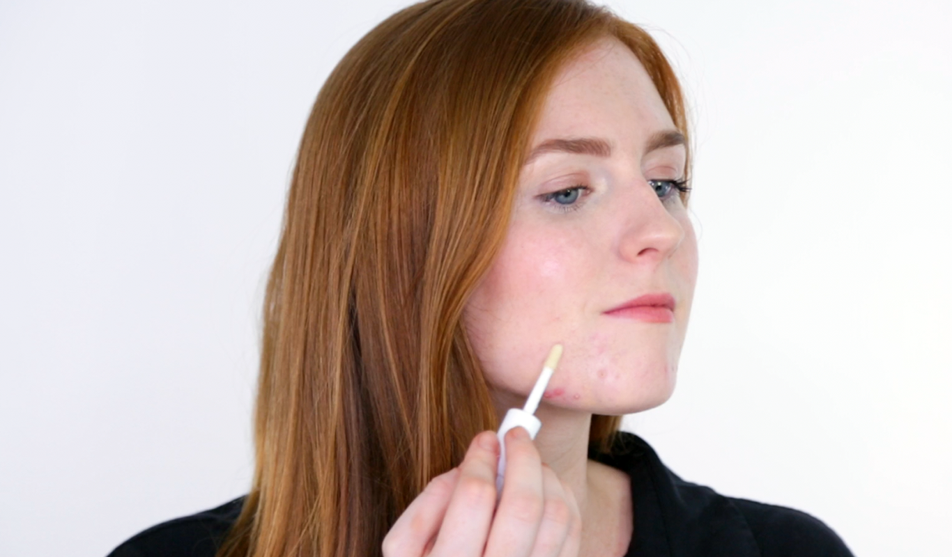 We try: The concealer that covers pimples and treats them at the same time