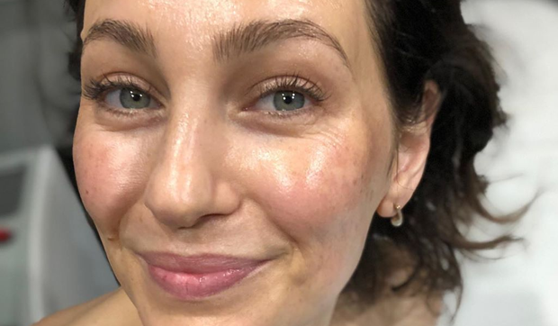 How to stop pigmentation from plaguing your summer