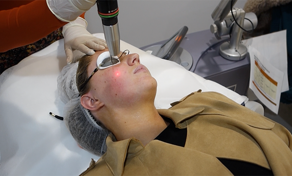 What is laser pigmentation removal and does it actually work?