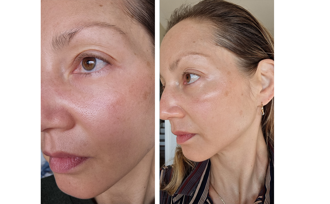 neutrogena serum before and after